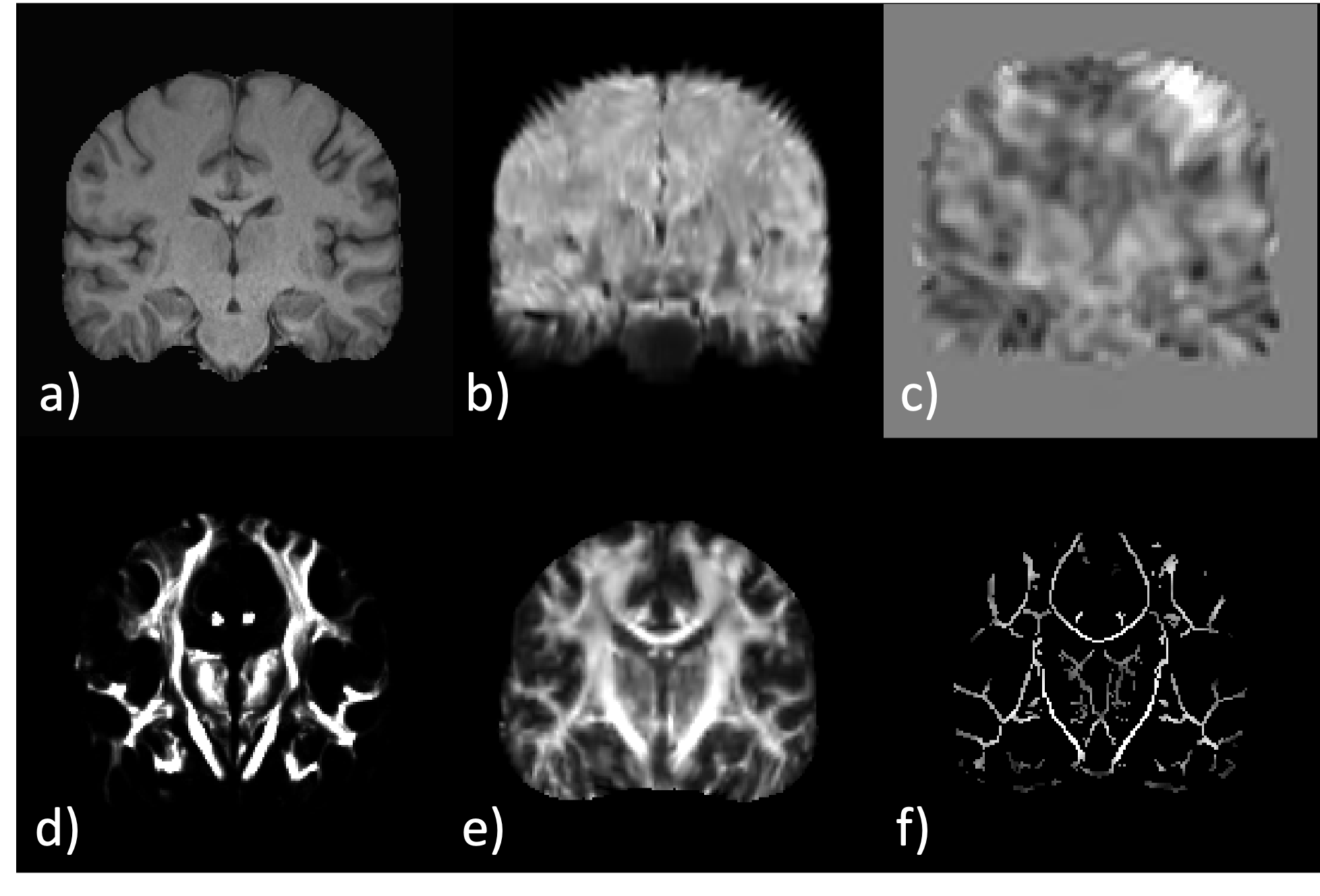 Example MRI Contrasts.